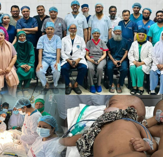 শিশু রুহি আর জুহিকে সফল ভাবে আলাদা করা হয়েছে