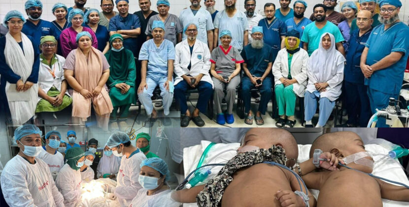 শিশু রুহি আর জুহিকে সফল ভাবে আলাদা করা হয়েছে